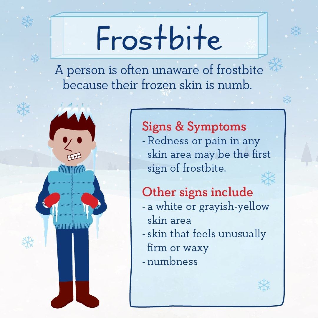 Infographic on recognizing symptoms of frostbite